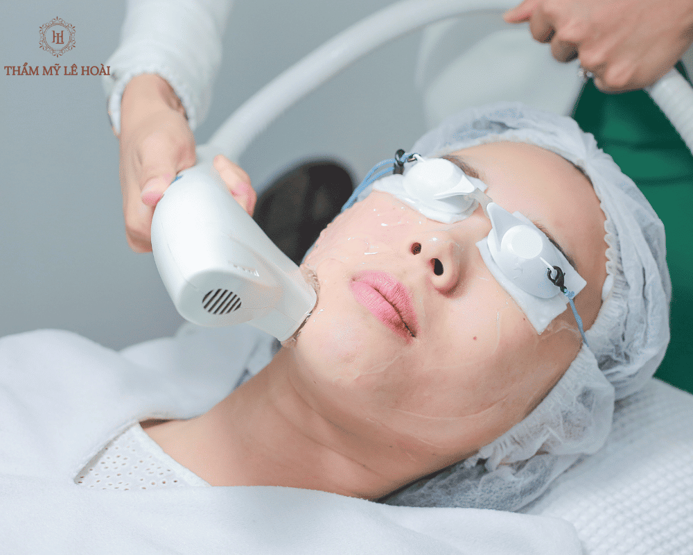 Cach cham soc da mat cho phu nu sau sinh