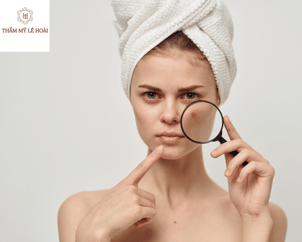 Da mat o tuoi day thi co mun phai lam sao