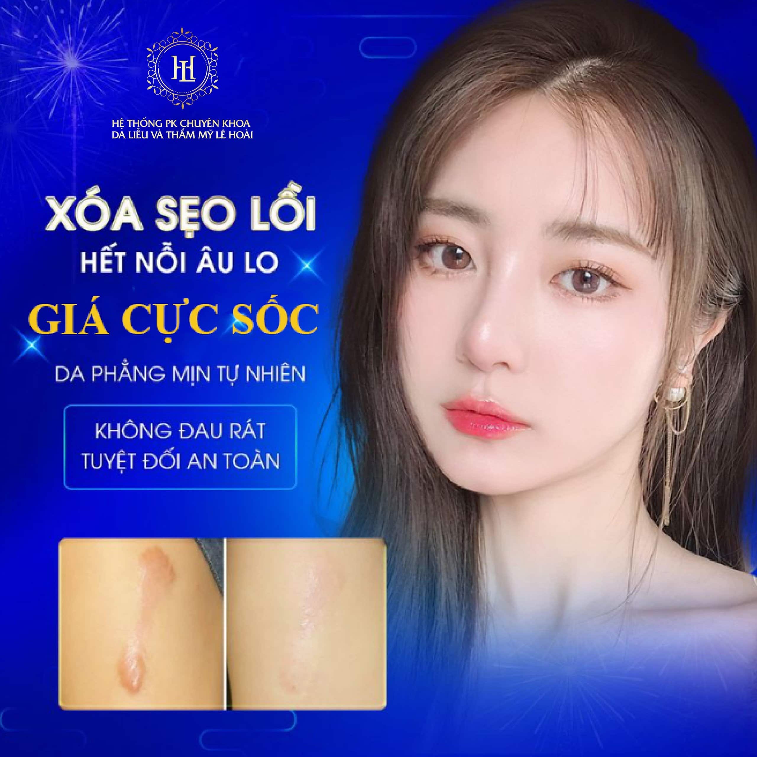 seo ro thammylehoai.vn 1