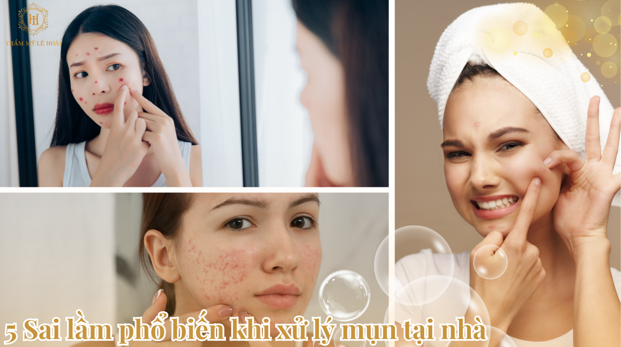 5 Sai Lầm Phổ Biến Khi Xử Lý Mụn Tại Nhà 6 5 Sai lầm phổ biên khi xử lý mụn tại nhà