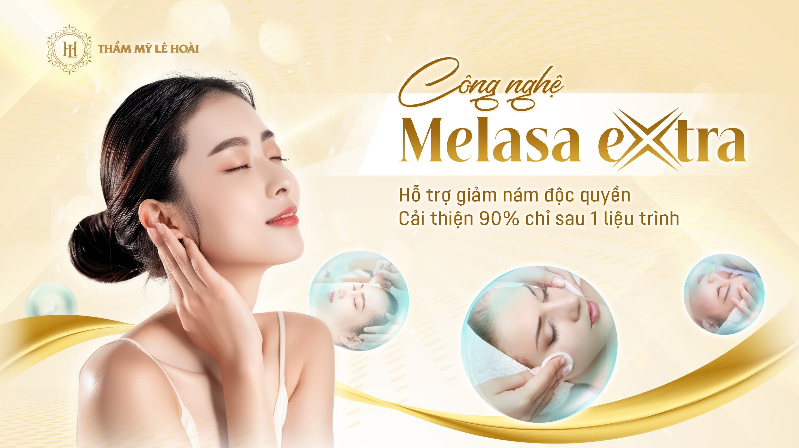 Phân Biệt Các Loại Nám Da và Cách Nhận Biết Chính Xác Nhất 6 Xử lý nám da tại Thẩm Mỹ Viện Lê Hoài