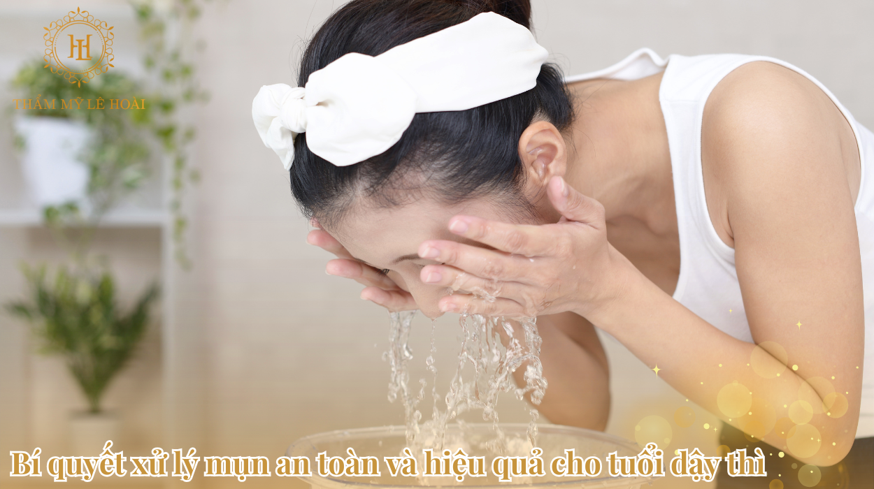 Bí quyết xử lý mụn an toàn và hiệu quả cho tuổi dậy thì