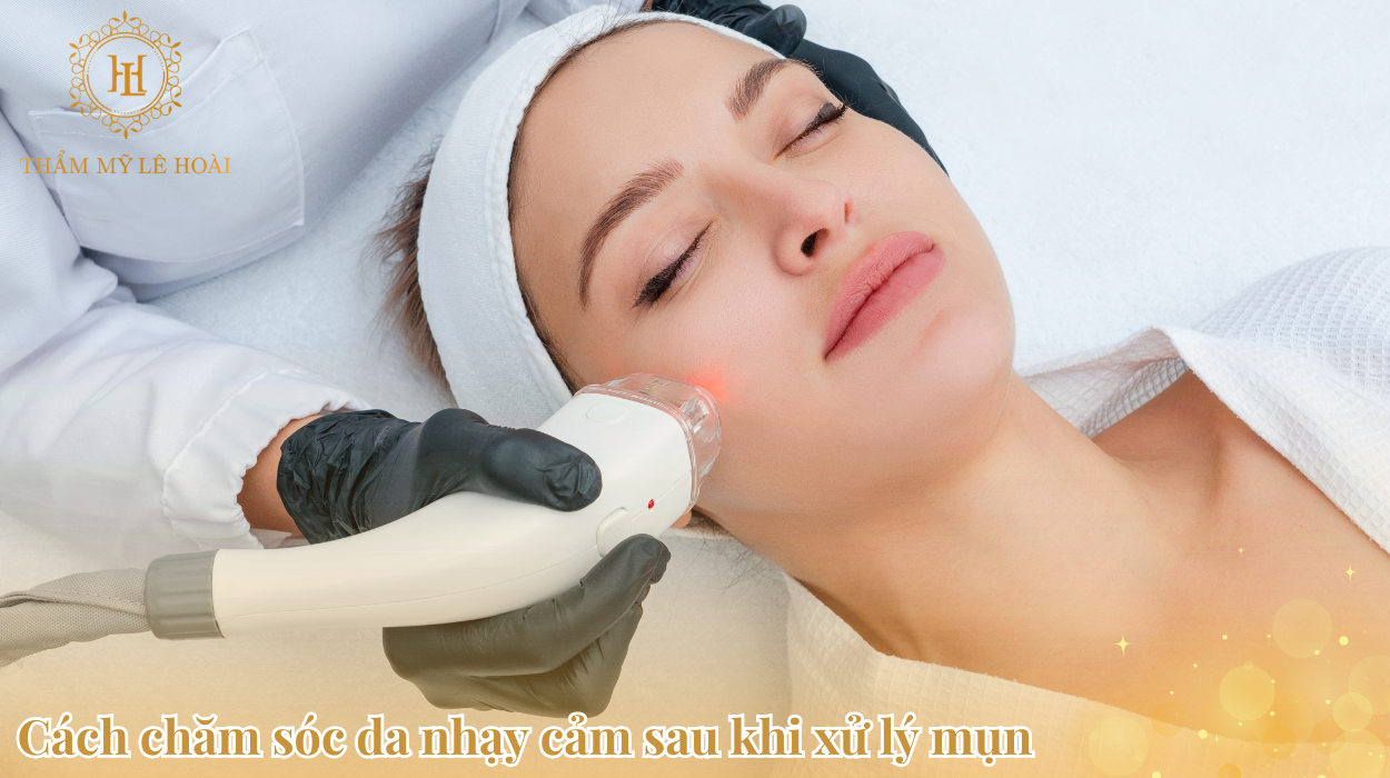 05 Cách chăm sóc da nhạy cảm sau khi xử lý mụn