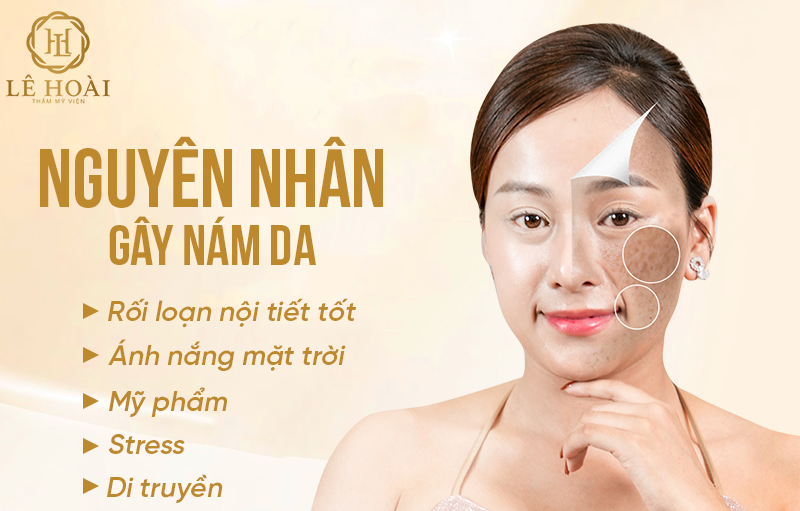 Nguyên nhân gây nám da và cách khắc phục