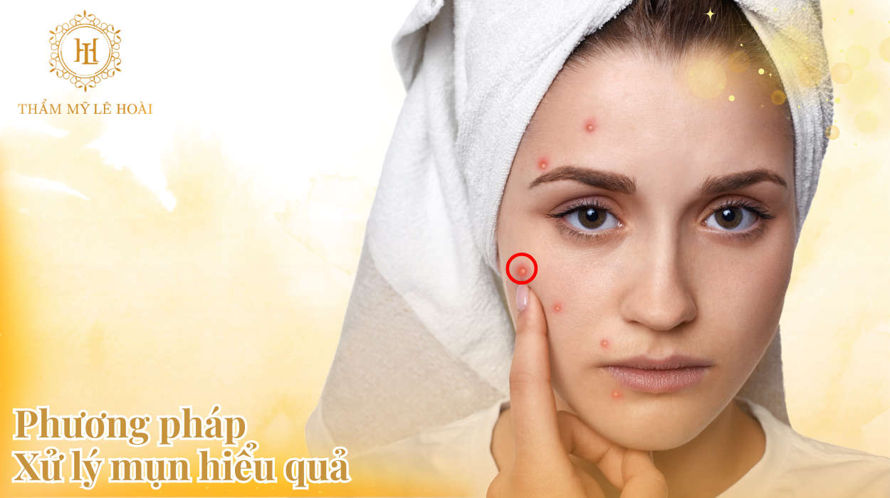 05 Phương pháp xử lý mun hiệu quả