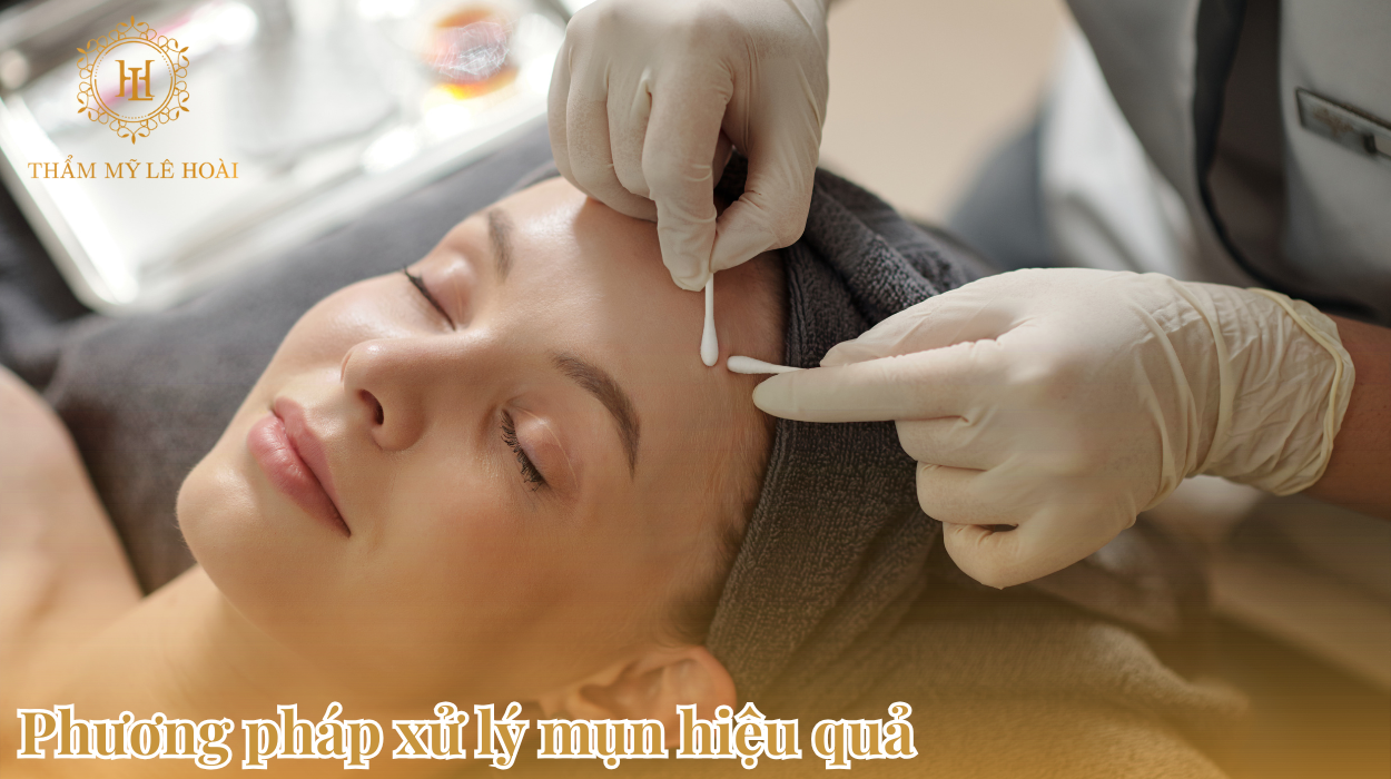 Phương pháp xử lý mụn hiệu quả | Thẩm mỹ viện Lê Hoài