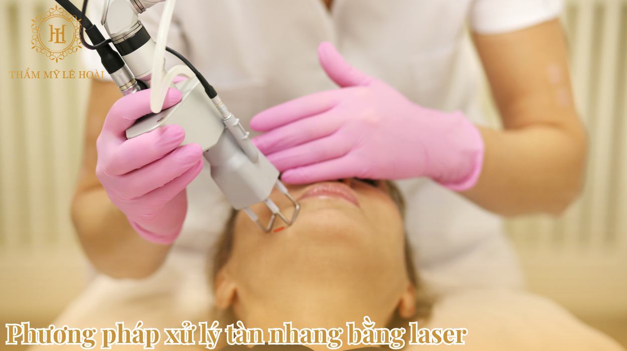 Phương pháp xử lý tàn nhang bằng Laser