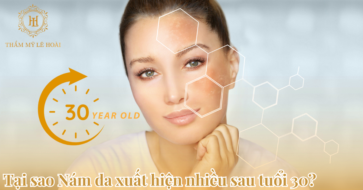 Tại sao Nám da xuất hiện nhiều sau tuổi 30