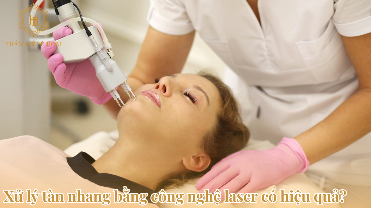Xử lý tàn nhang bằng công nghệ Laser có hiệu quả không?