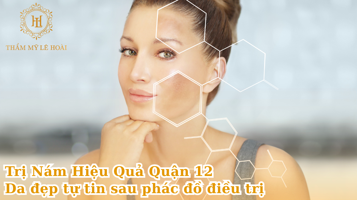 Trị nám hiệu quả quận 12 – da đẹp tự tin sau phác đồ điều trị | Thẩm mỹ Lê Hoài
