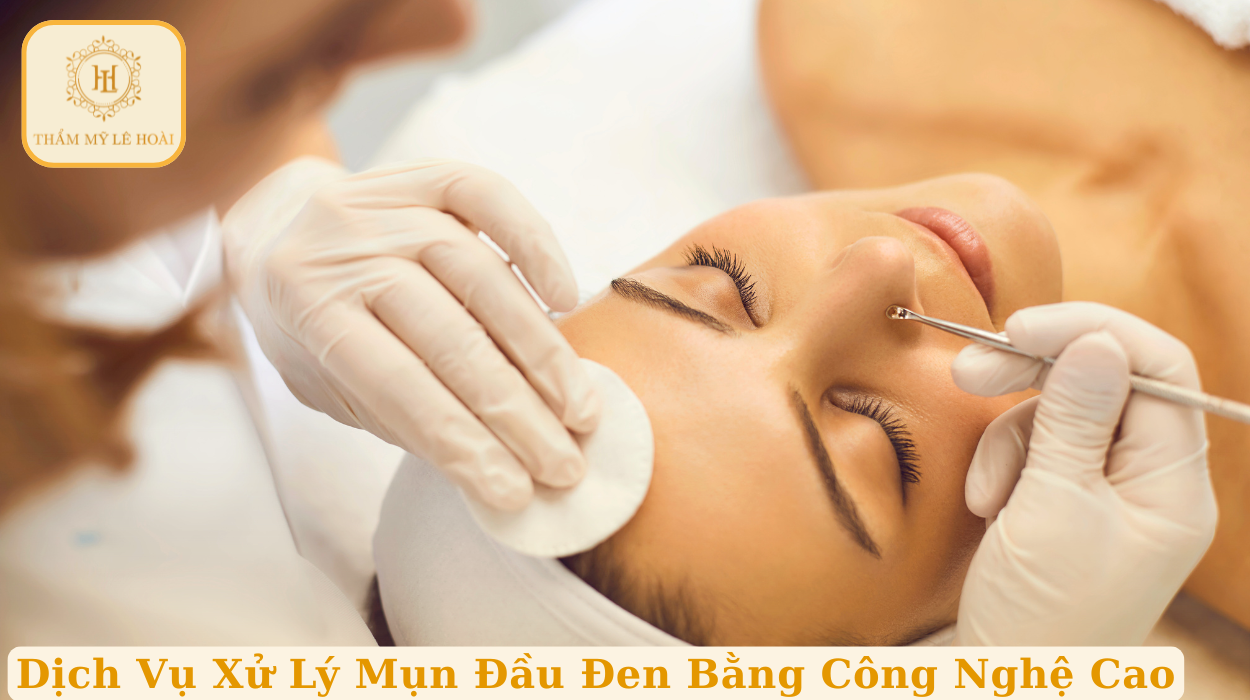Dịch Vụ Xử Lý Mụn Đầu Đen Bằng Công Nghệ Cao 6 Dịch Vụ Xử Lý Mụn Đầu Đen Bằng Công Nghệ Cao | Thẩm mỹ Lê Hoài