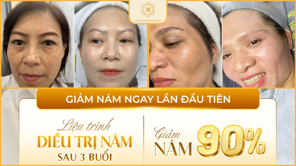 Giải pháp xử lý nám dành cho người lớn tuổi tại quận 12 | Medicnarci Korea