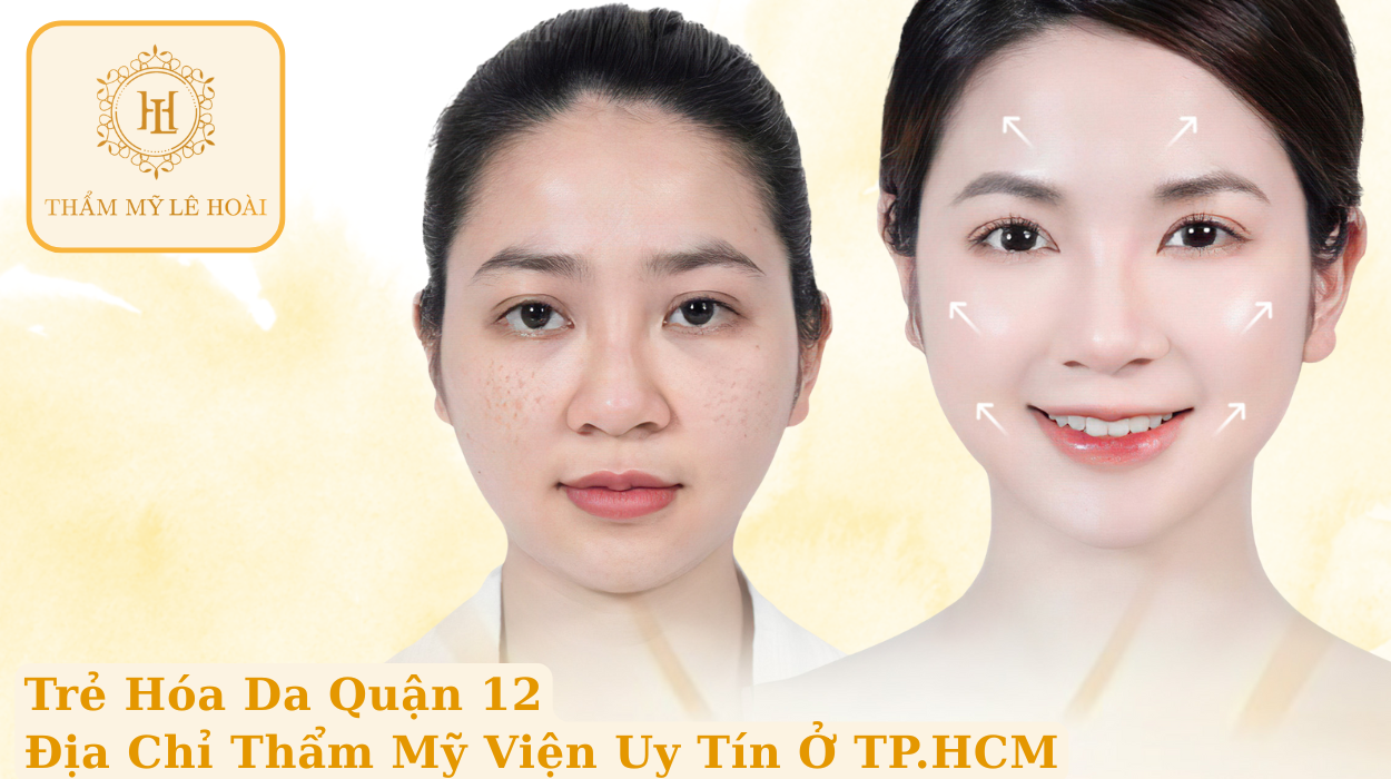 Trẻ Hóa Da Quận 12 – Địa chỉ Thẩm mỹ viện uy tín ở Tp.HCM | Thẩm mỹ Lê Hoài